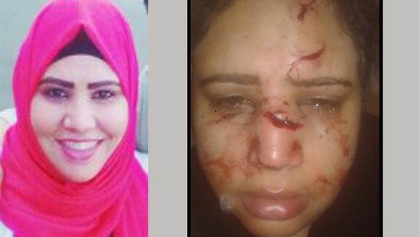 بلطجية يعتدون بالضرب على ” محامية ” بالأميرية (صور)