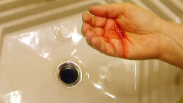 تعرف على أسباب كحة الدم (فيديو)