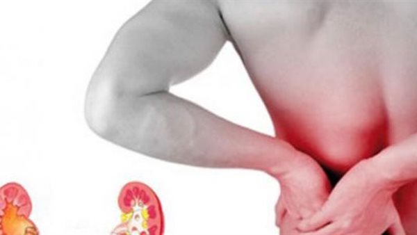  أعراض الحصوات على الكلى.. تغير لون البول وألم بالظهر» (فيديو)