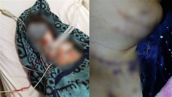  شيطان في ثوب الأخ.. أم وطفلتها في مواجهة الموت بسبب شقيق الزوج ببولاق الدكرور
