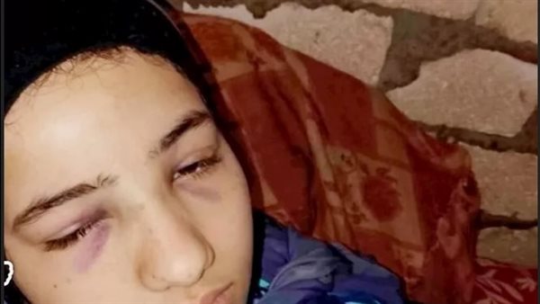 دخلت ثلاجة الموتى بالخطأ.. لحظات رعب لفتاة في حادث صحراوي المنوفية