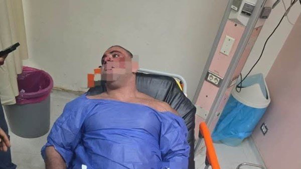 خناقة ورصاص ودمـ.ـاء.. القصة الكاملة لإطلاق بودي جارد الرصاص على مدير جولدن جيم بالشيخ زايد