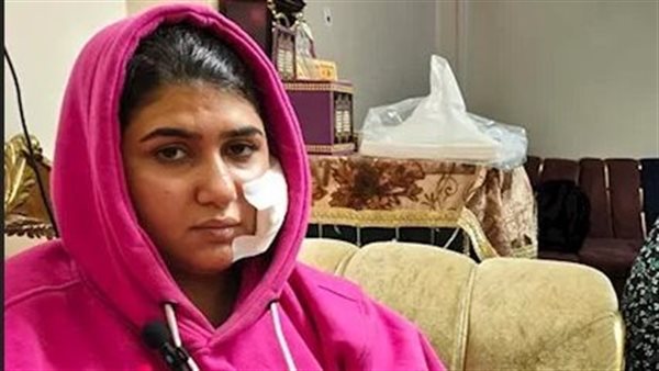 خلعته قبل الدخلة.. جزار بلبيس يُشوّه وجه عروسه ويُطلق عليها كلبًا شرسًا