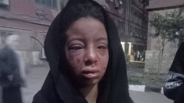 التفاصيل الكاملة لإحالة المتهم بالتعدي على الطفلة شيماء لمحكمة الجنايات بالشرقية