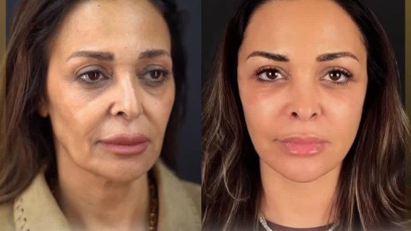 ملامحها اتغيرت..داليا البحيري تثير الجدل بعد عملية تجميل | فيديو