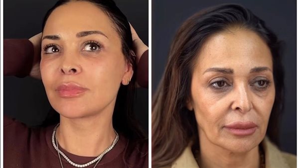  بعد جدل عملية التجميل.. داليا البحيري تخطف الأنظار بهذه الإطلالة | شاهد