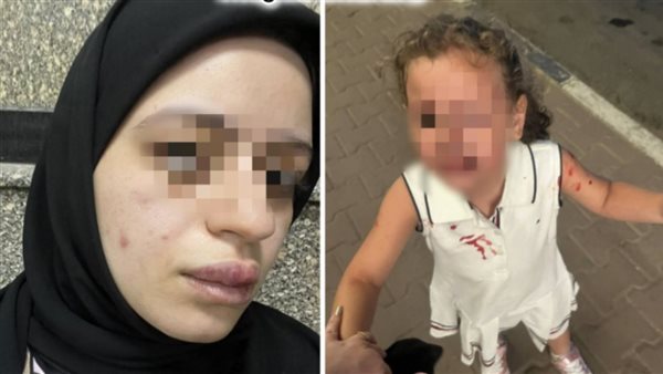 يحتمي بالجنسية الأمريكية..تفاصيل صادمة في اتهام سيدة لطليقها بالاعتداء عليها وابنتها