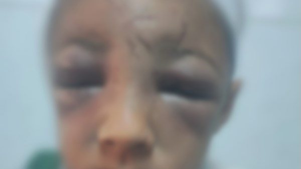 ضيع 10 جنيه باقي ثمن علبة سجائر.. أب يعذب ابنه بطريقة بشعة في الغربية | فيديو