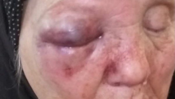 تفاصيل صادمة.. الابن العاق ضرب أمه للحصول على أموال لشراء مخدرات بالغربية