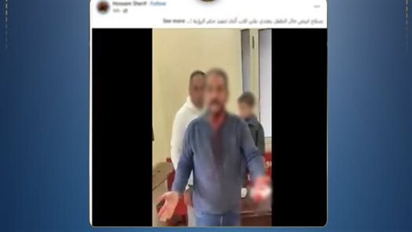 بسبب رؤية طفله.. تفاصيل مشاجرة مهندس وطليقته وشقيقها بالبحيرة