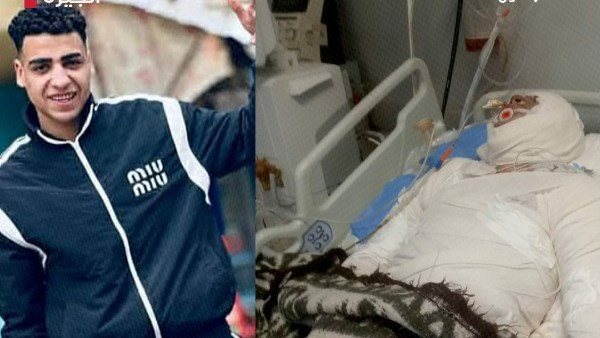  جريمة هزت بولاق الدكرور.. تفاصيل مأساوية في حرق شاب بالبنزين أمام الأهالي