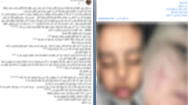  تفاصيل استغاثة سيدة من تعدي جيرانها عليها ونجلها بالضرب بالغربية 