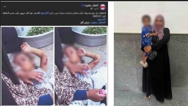 تفاصيل القبض على المتهمة باستغلال ابنتها المصابة بحروق في أعمال التسول بالشرقية 