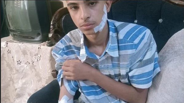 تفاصيل إصابة طالب بـ60 غرزة على يد آخر في 6 أكتوبر