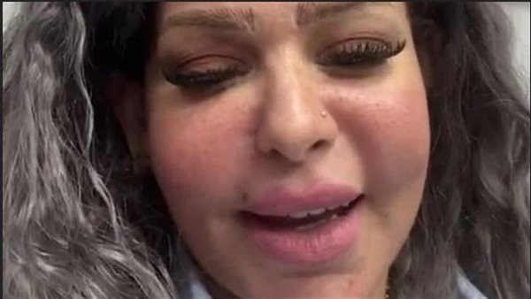 قالي اتعالجي في الزريبة.. تفاصيل مشاجرة إيمي تاتو في مستشفى بمصر الجديدة | فيديو