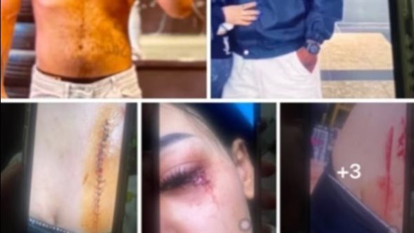 جوزي عايز يجوزني لسعودي شهرين عرفي.. استغاثة حسناء باب الشعرية تثير الغضب