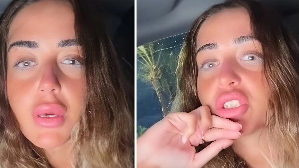  إنتوا فلاحين ولا إيه؟.. فتاة تثير الجدل بهجومها على شباب الساحل: ماشيين عريانين | فيديو