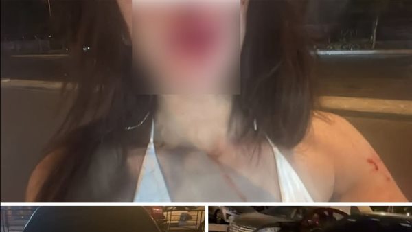 تفاصيل الاعتداء على سيدة في التجمع | فيديو