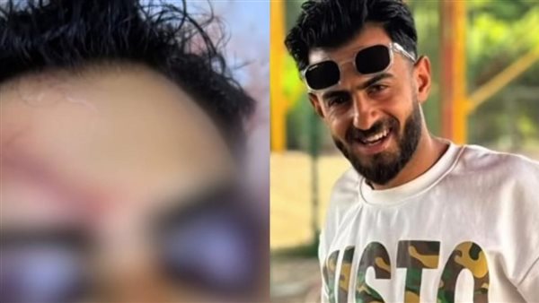  طوب وعاهة مستديمة.. تفاصيل مأساة قهوجي على يد بلطجية الحوامدية 