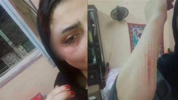 مسكته بيخونها.. تفاصيل التحقيق مع المتهم بالتعدي على زوجته في حلوان 