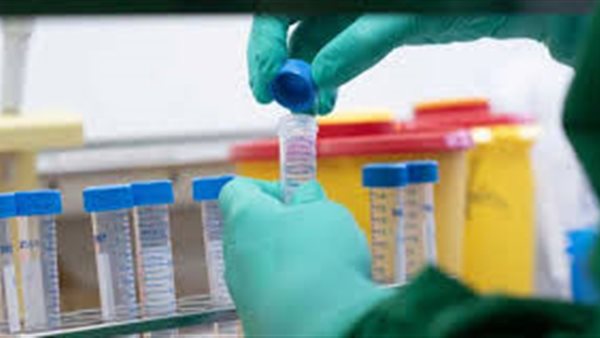 تفاصيل تنفيذ مصر تجربة سريرية لعلاج فيروس كورونا | فيديو