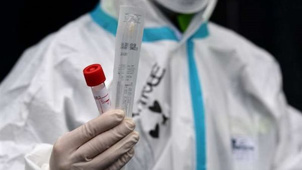  تحذير جديد .. علماء يحددون علامة جديدة تشير للإصابة بفيروس كورونا 