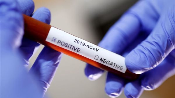 عاجل .. الصحة تعلن ارتفاع عدد حالات فيروس كورونا وعدد المتعافين وحالات الوفاة الجديدة