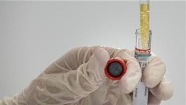 جمال شعبان : فيروس كورونا خبيث | فيديو 