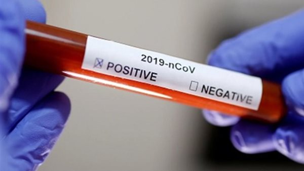 طبيب شهير: السجائر تساعد فيروس كورونا وتزيد نشاطه | فيديو