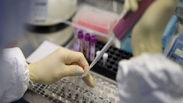 4 أمراض تجعلك من أكثر الناس عرضة لفتك فيروس كورونا 