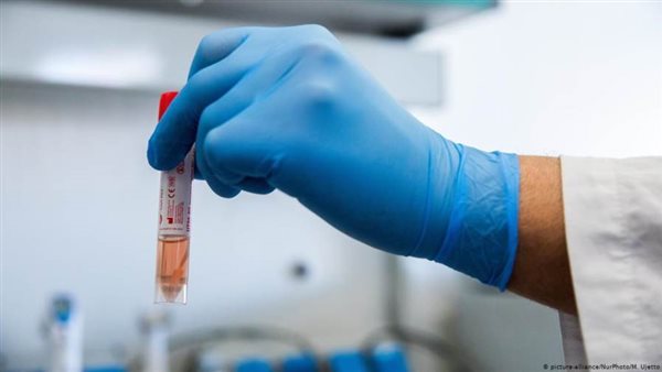 هل أصبح فيروس كورونا ضعيفا؟ 