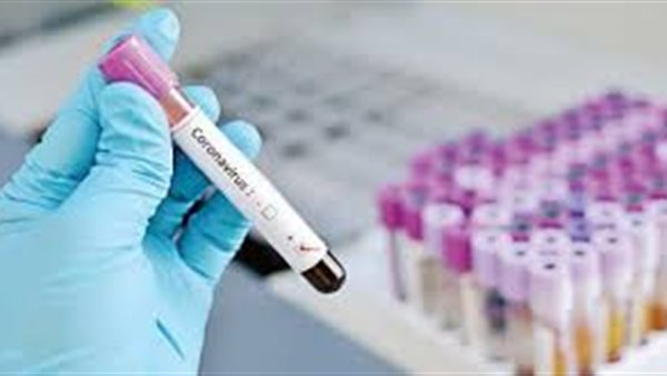 أستاذ بهارفارد : إنتاج اللقاحات يستغرق أسبوع.. والتجارب السريرية تحتاج  وقت كبير | فيديو