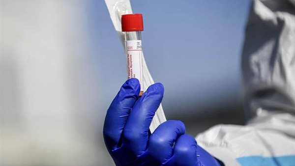 بلجيكا تستعد لإنتاج مصل كورونا فى أكتوبر.. والسعر مفاجأة | فيديو