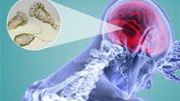 الأميبا آكلة الدماغ..كارثة جديدة تهدد العالم بعد كورونا والطاعون الدبلي