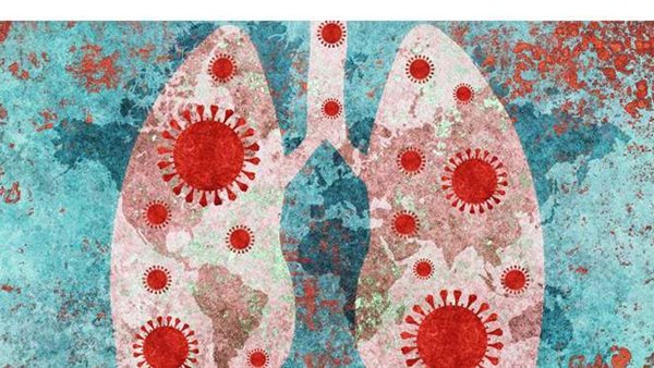 كورونا يحول رئتي مصابة إلى 