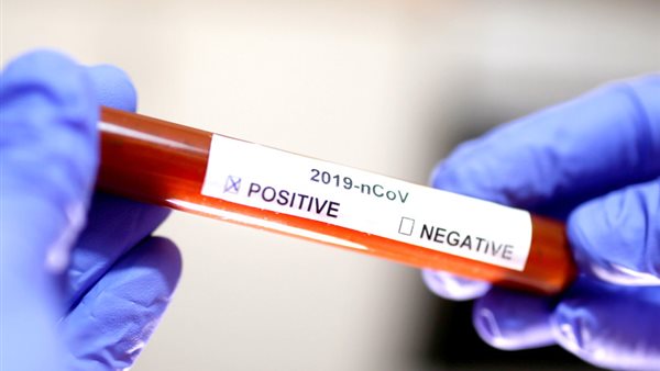 أول تعليق من الصحة عن أسباب زيادة حالات كورونا | فيديو