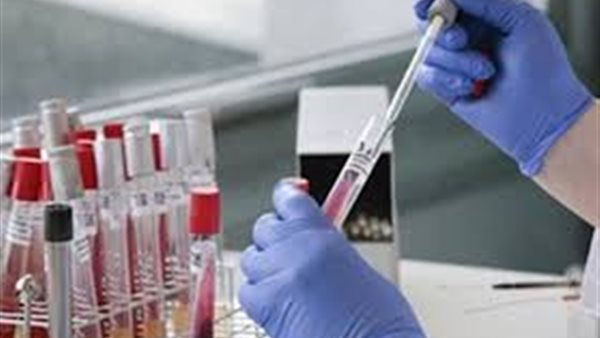 أستاذ فيروسات بفرنسا يزف بشرى سارة عن لقاحات كورونا 