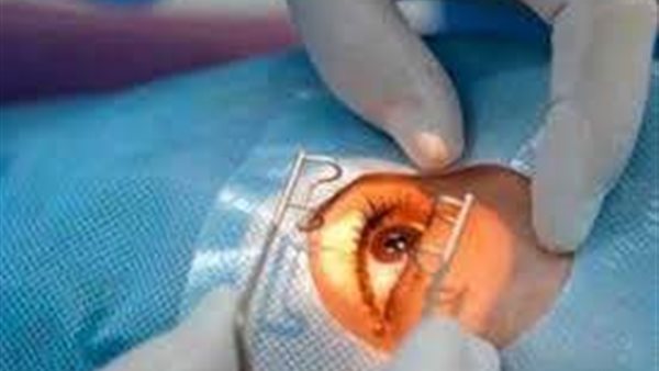 استشاري عيون: إجراء ليزر لطفل صغير أمر ممنوع منعًا باتًا لهذا السبب | فيديو