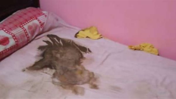 مفاجآت جديدة في واقعة رضيع طوخ الميت جوعا 