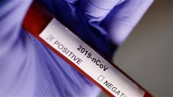 مفاجأة مثيرة.. فيروس كورونا موجود منذ القدم ويصيبنا سنويا