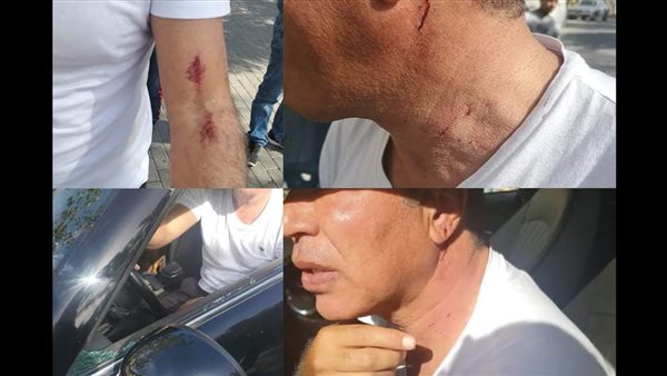 جماهير الزمالك ضربته بالطوب.. تفاصيل ساعات رعب عاشها أيمن يونس | صور