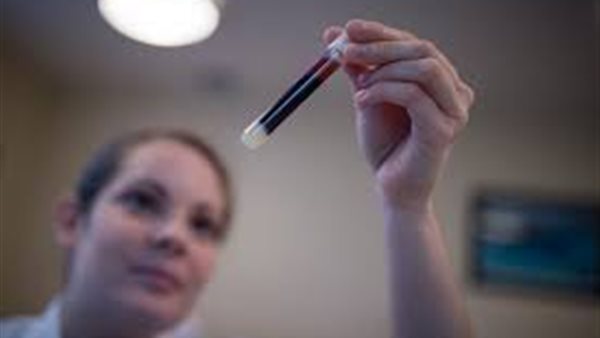 مفاجأة.. دراسة جديدة تكشف الفئة الأكثر عرضة للإصابة بكورونا | فيديو