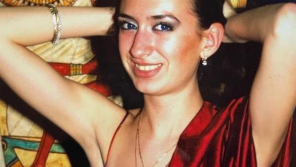 لن تصدق.. كيف تبدو صاحبة أكبر خدود في العالم قبل وبعد عمليات التجميل | شاهد