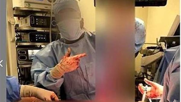  كانوا بيلعبوا.. أطباء نساء وتوليد يعبثون بأعضاء مريض بغرفة العمليات | فيديو 