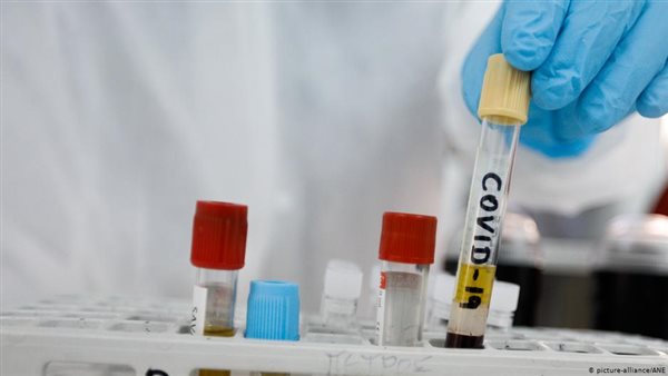 غير متوقعة..ظهور 3 أعراض جديدة لفيروس كورونا