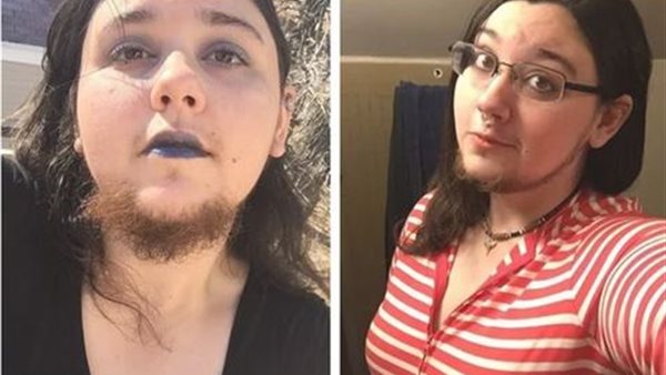 آخر التقاليع .. سيدة تطلق لحيتها وترفض حلاقتها طوال 12 عاما | شاهد