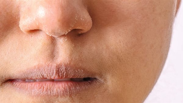 فوائدها مذهلة..7 وصفات طبيعية تخلصك من جفاف البشرة أثناء الصيام