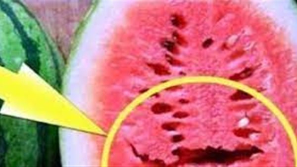 كلمة السر في الحجم ولون القشرة..كيفية معرفة البطيخ المسرطن