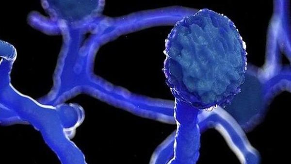 صدمة.. رئيس لجنة مكافحة كورونا يكشف حالات الإصابة بالفطر الأسود في مصر 