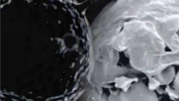 أيهما أخطر؟..طبيب يوضح الفرق بين مرض الفطر الأسود والأبيض | فيديو